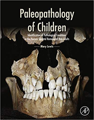 Paleopathology of Children: Identification of Pathological Conditions in the Human Skeletal Remains of Non-Adults - Orginal Pdf